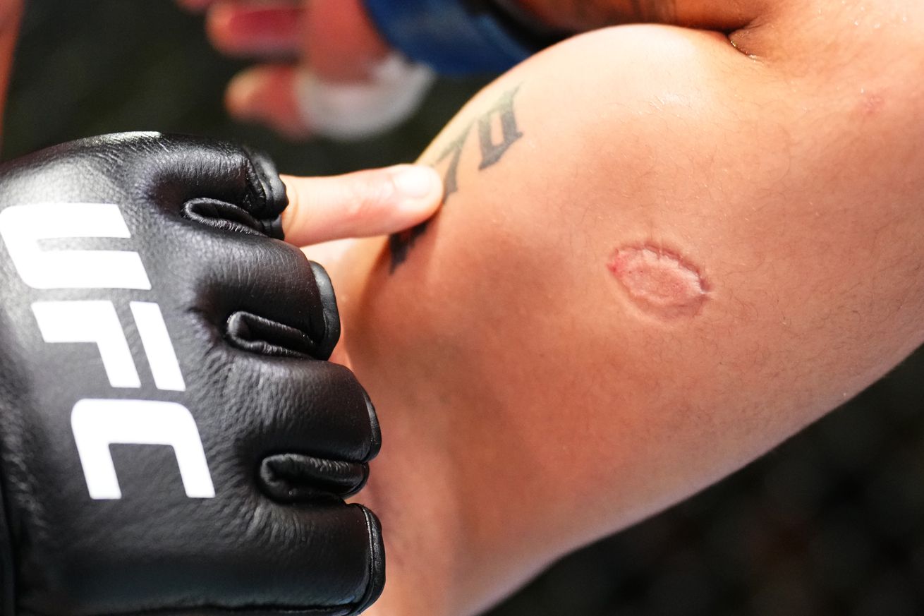 UFC Fight Night: Severino v Lima